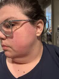 I think this is the only ICP group I'm in, so I'm going to ask here.. Has  anyone or their kiddos been treated differently or judged wearing their ICP  gear out? We