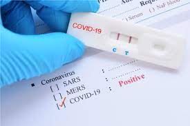 In this video, tpirc founder and chief medical officer dr. Covid 19 Testing And Positive Test Results