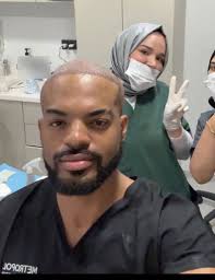 asked for a transplant & they turned him to squidward 😭