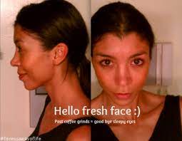 Bye Bye Puffy Eyes Hello Fresh Face Fitnessawayoflife Puffy Eyes Homemade Beauty Remedies Natural Beauty Diy