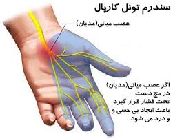 نتیجه تصویری برای درد کف دست