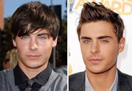 Zac efron has social media abuzz after fans took note to his appearance. Zac Efron Nose Job Before After Nose Job Celebrity Plastic Surgery Celebrities