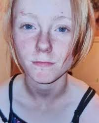 MISSING: Lilly Mae Williams-Rose from Leeds. Lilly Mae (15) who was  reported missing during the evening of Thursday 17 July. She is described  as white, slim with blue eyes and medium blonde