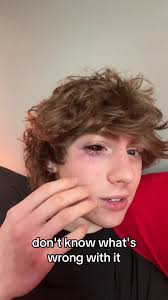 Help whats wrong with my eye 😭