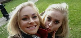 Who are plastic surgery twins Daisy and Dolly?