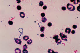 Image result for Group D Streptococcus
