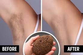 To reduce your risk of ingrown hairs, exfoliate your legs. 9 Ways To Make Your Arm Hair Less Noticeable