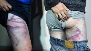 18, 18 years old, teen, young, 18 anal, 18 hd and much more. If You Croak We Don T Care Brutality In Belarus Bbc News