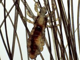 For example, lice eggs cannot hatch in temperatures lower than that of the average body temperature, which is 98.6 degrees fahrenheit. Head Lice 101 What Lice Look Like How They Behave And How Kids Get Them Babycenter