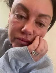 Liberty X star Michelle Heaton 'happiest and healthiest' after alcoholism  battle