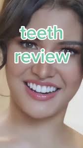 Rabiya Mateo Teeth Before