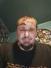 Apollo City Pro Scooter Accident and Safety Precautions