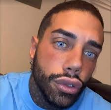 Francesco Chiofalo: " mi voglio sottoporre ad un intervento per allungare  le gambe. Io ho fatto il fotomodello per tanti anni e non sono mai riuscito  a fare passerella perché mi mancavano