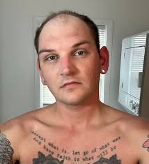 What would I look like with a bald head?