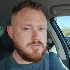 What to do about hair thinning and loss after bariatric surgery?