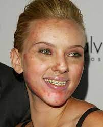 Allerdings ist das nicht der offizielle titel, den angelina jolie oder scarlett johansson bereits bekommen haben. Pickel Fetthaar Was Ist Denn Mit Euch Passiert
