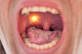 How to stop my braces from hurting? Why Does My Mouth Feel Dry With Braces Hansen Ortho