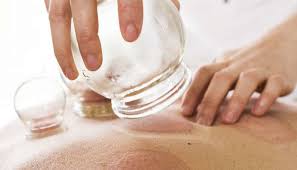 Seattle institute of east asian medicine. Does Cupping Therapy Work And What Are The Benefits