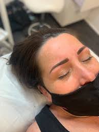 Cosmetic Tattoo Treatment in Melbourne