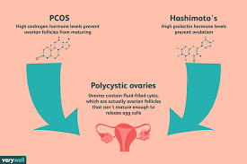 It can also result in problems with your hair, skin. Is There A Link Between Pcos And Hypothyroidism