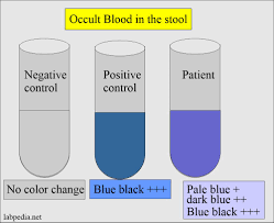 Originally when the test was first this is a guaiac based fobt test. Stool Examination Part 5 Stool For Occult Blood Ob Fecal Occult Blood Labpedia Net
