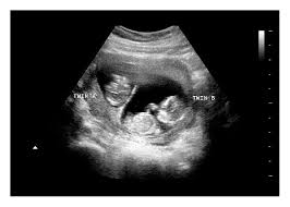 To use this just hold it to. Fake Ultrasound Generator For Free Baby Maybe