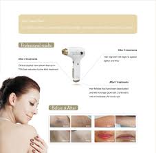 Laser hair removal took the beauty industry by storm in the 1990s. Laser Hair Removal Is Not A Big Deal Now Maria Trading
