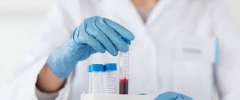 Image result for Lactose Tolerance Test