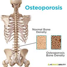 Bones in your back diagram. What Type Of Vertebrae Spine Pain Do I Have