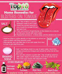 Home Remedies To Get Rid Of Tongue Blisters Top 10 Home Remedies Canker Sore On Tongue Natural Home Remedies Home Remedies