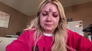 Bride-to-be punched, knocked out during her bachelorette trip