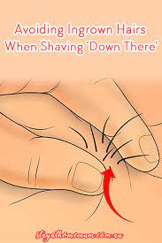 Avoiding Ingrown Hairs When Shaving Â€˜Down There'