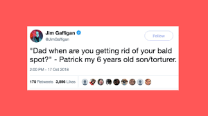 Is there a physiological process through which extreme stress can cause. 33 Relatable Tweets For Men Who Are Going Bald Huffpost Life