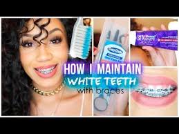 Be sure to thoroughly clean around your brackets, beneath wires and between each tooth to keep your smile as white as possible. How I Maintain White Teeth With Braces White Teeth With Braces Dental Braces Braces Tips