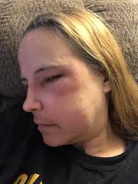 Prayers appreciated. Been struggling with allergies/ sinuses. Glands  swollen, difficult & painful to swallow.