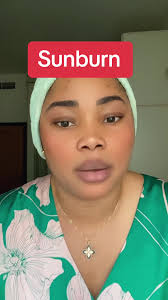 Effective Sunburn Treatment: Complete Set for 22,000 Naira!