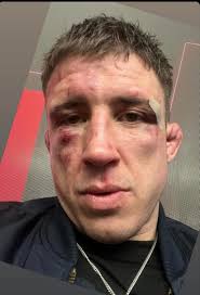 Norman went through a WAR in Poland last night 🤕 Man's a Warrior 💯  'Stormin' Norman Parke