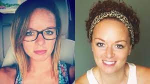 Dare To Bare Your Chemo Hair Loss Chemo Hair Long Hair Styles Men Chemo Hair Loss