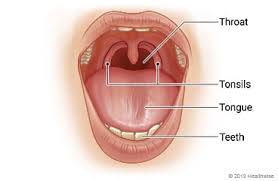 Image result for Strep throat infection roof of mouth