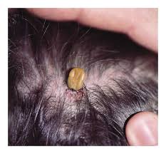Image result for Tick Paralysis