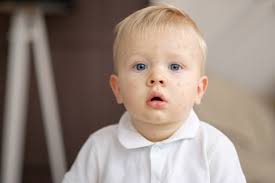 La peau est grasse, parsemée de pustules, de petits boutons blancs… difficile de se tromper. Affections De La Peau Chez Le Bebe Les Reconnaitre Et Les Soigner Lmdm