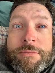 Hi, my best friend just had an eye operation? Could someone please turn him  m into a pirate. Many thanks..