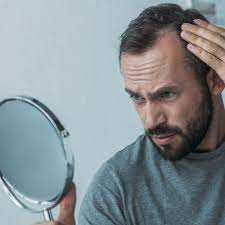 The scalp is the most commonly affected area, although patients commonly report the loss of hair. Which Antidepressant Causes The Most Hair Loss Roman Healthguide