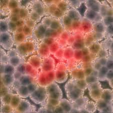 Researchers Develop First Human Stem Cell Derived Model Of A Stem Cells Cord Blood Banking Muscular Dystrophies