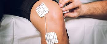 Image result for Electrical Stimulation Therapy