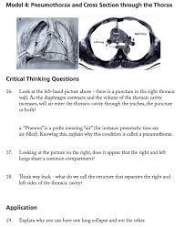 I am assuming thorax refers to one's sternum or to be more precise. Solved Model 4 Pneumothorax And Cross Section Through Th Chegg Com