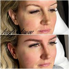 Kyle McCracken DDS, 5509 Pleasant Valley Dr, Plano, TX 75023, US