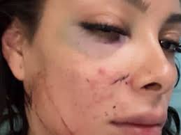 Fundraiser for Monserrat Medina by Eden Rivera : Support Monserrat's  Recovery Journey