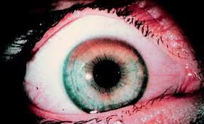 Rib cage pain is a common complaint that can be caused by factors, ranging from a many cases of rib cage pain are not linked to serious conditions and resolve on their own or with minimal treatment. Pathophysiology Springerlink