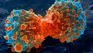 Also called gastric cancer, the disease usually grows slowly over many years. Symptoms For Stomach Cancer Samayam Tamil Photogallery